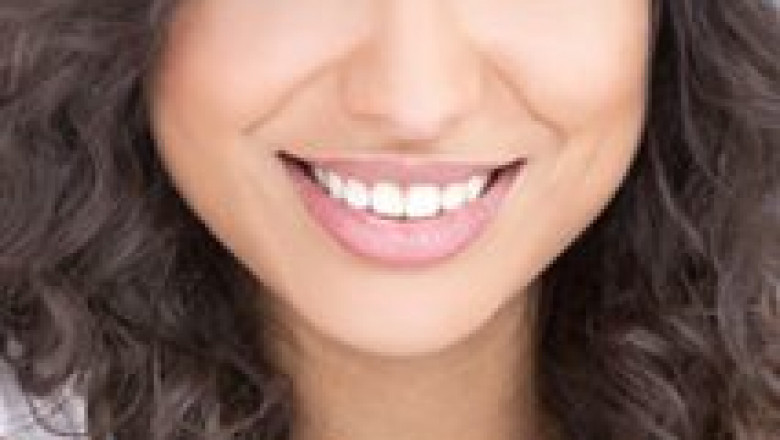 Care Dental Spa – Your most reliable professional cosmetic dentist in TX.