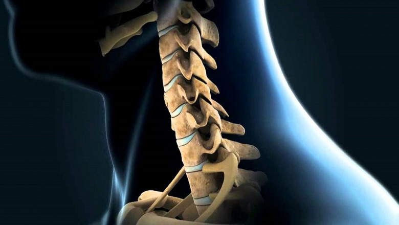 Market Analysis: Total Disc Replacement Market Global Industry Trends, Share, Size, Growth, Opportunity and Forecast 2022-2028