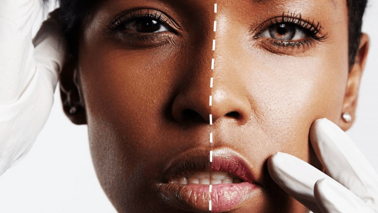 The Global Anti-Skinning Agents Market: Size, Share, Growth, Opportunity, And Forecast, 2022-2028