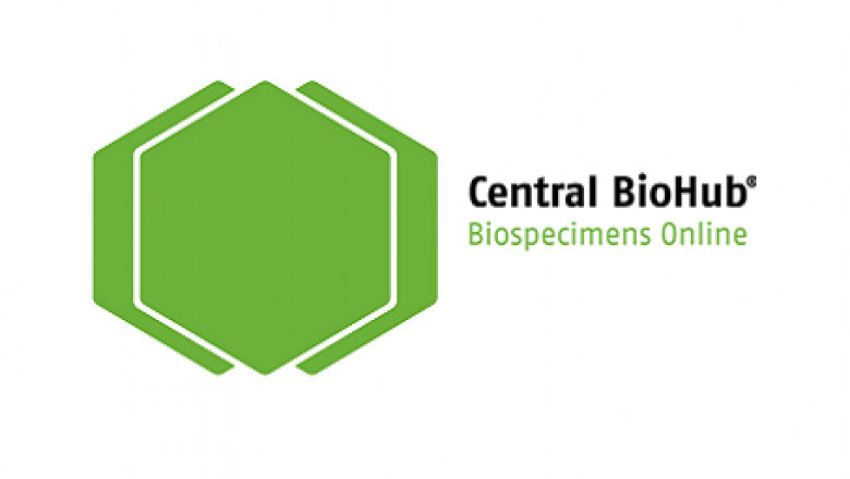 Buy Cancer Samples from patients