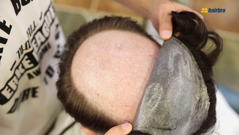 Hair Systems