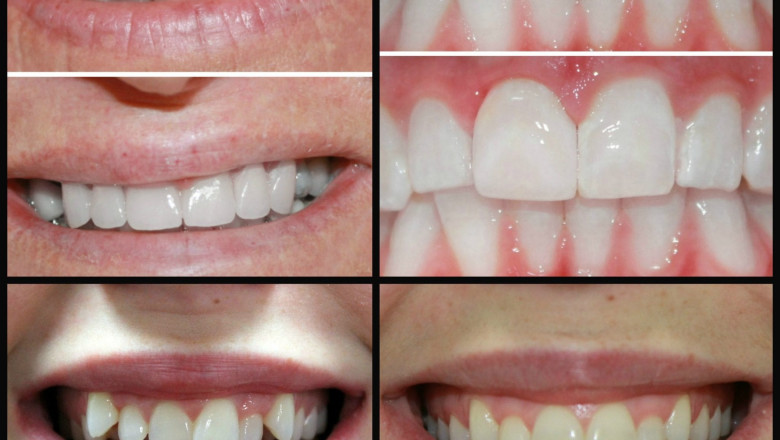 The Importance of Cosmetic Dentistry