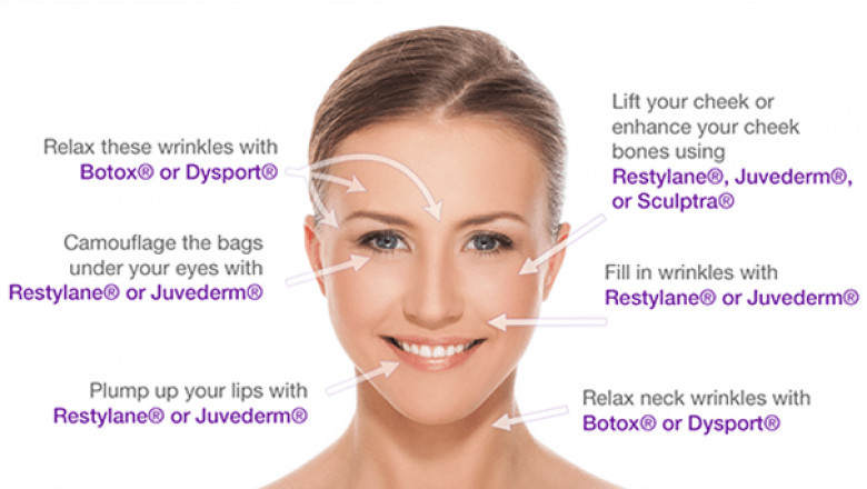 Buy allergan botox online usa