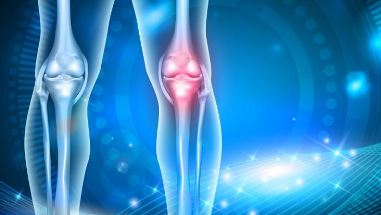 Osteoarthritis Market to Advance at CAGR of 8.7% During 2021-2028; Sanofi, Horizon Therapeutics PLC, Johnson &amp; Johnson