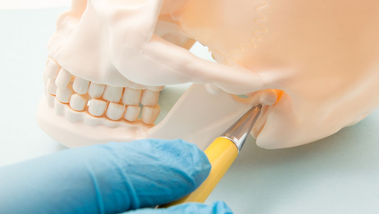 What Does Treating TMJ Involve?