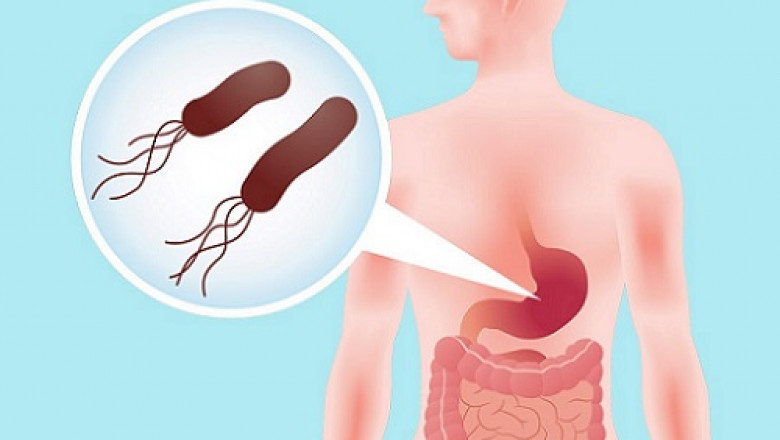 Helicobacter Pylori Diagnostics Market to Exceed Valuation of USD 671 Mn by 2028, Research informatic