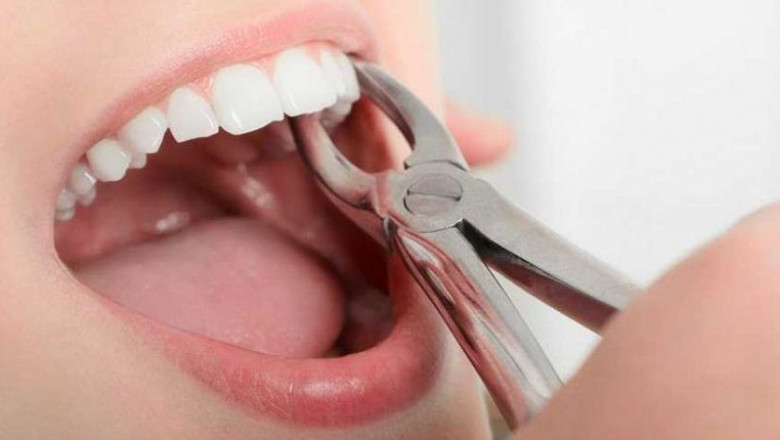 How to Learn If You Have Gum Disease?