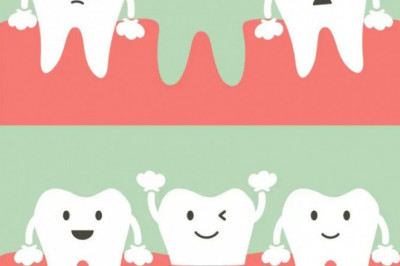 The Cost of Dental Implants - Factors That Affect the Price of the Procedure