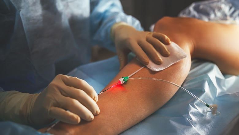 What Factors Help Increase The Risk Of Developing Varicose Veins?