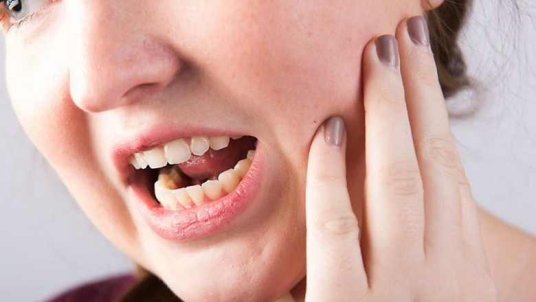 How Long A Root Canal Will Take?