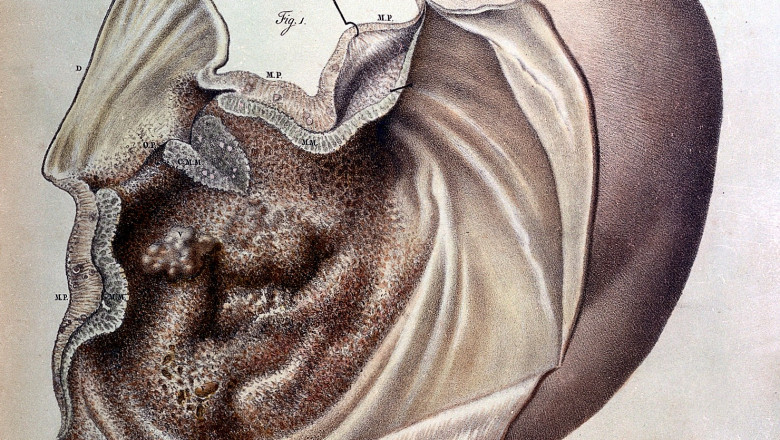 Gastric Cancer Market – Global Industry Analysis, Size, Share, Growth, Trends, and Forecast - 2022-27