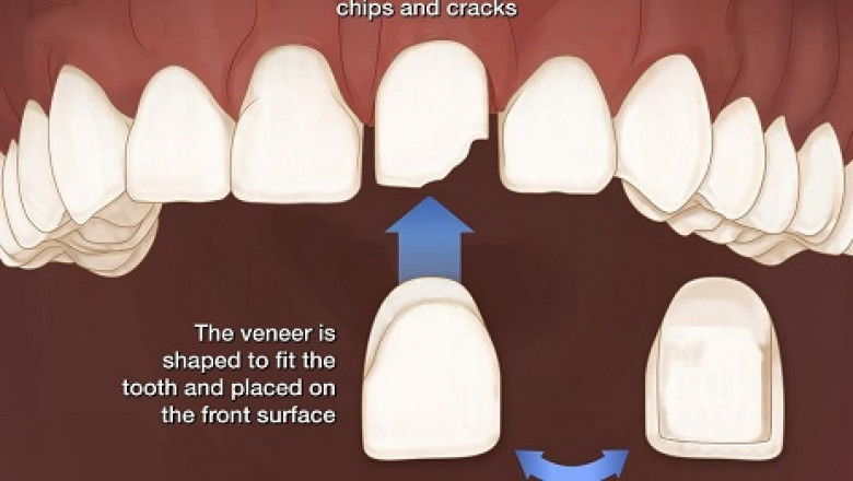 What to Consider in Selecting the Dentist Office For You