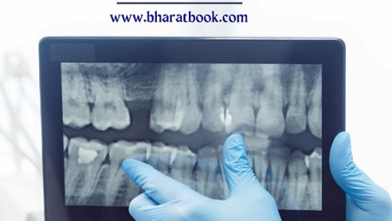 Global Dental X-Ray Market Forecast to 2022-2028