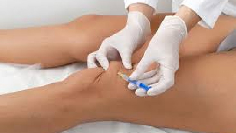Hyaluronic Acid Viscosupplementation Market to Flourish with an Impressive CAGR during 2021-2030