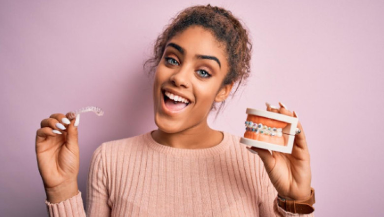 11 Things You Need To Know Before Getting Clear Aligners!