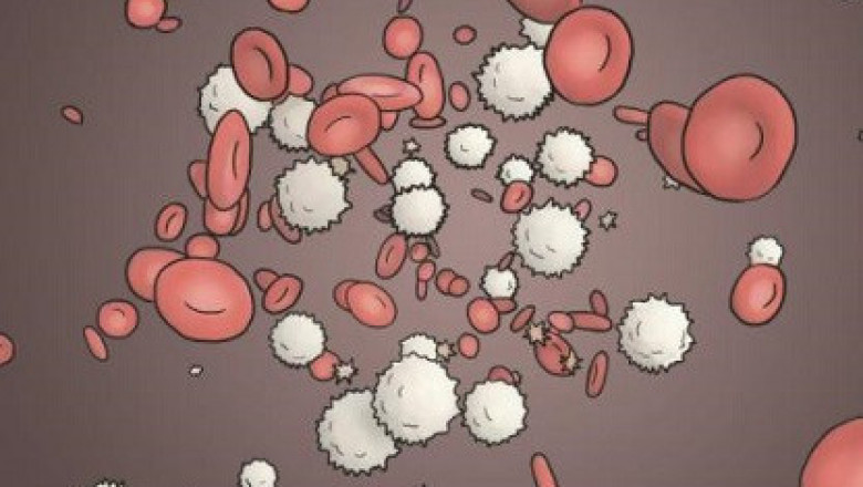 Can Prostatitis be Diagnosed from Leukocytes Alone?