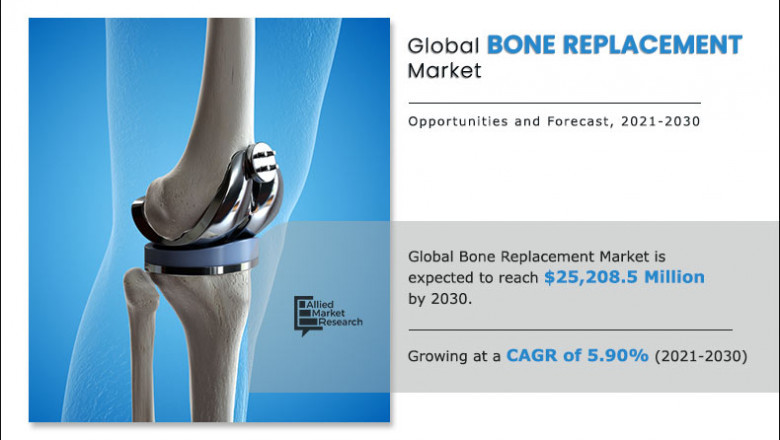 Bone Replacement Market is Set for an Outstanding Growth in Next 5 Years