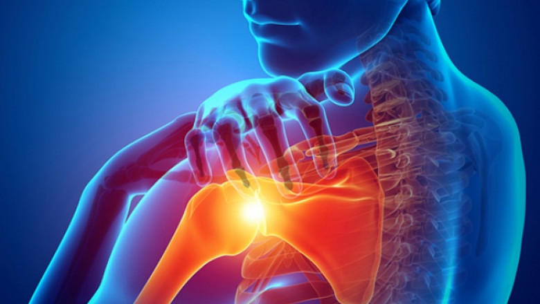 WHAT ARE THE MOST COMMON SHOULDER INJURIES?