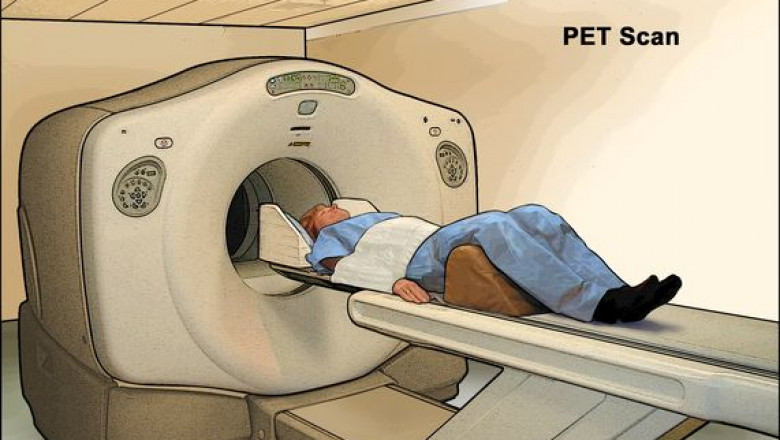 How risky is a PET scan?