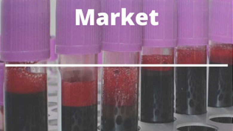 Global Coagulation Testing Market worth US$3,612.665 million by 2027