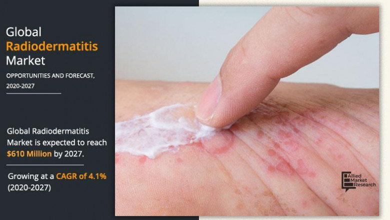 The Future of Radiodermatitis Market | Growth Opportunity and Industry Forecast, 2027