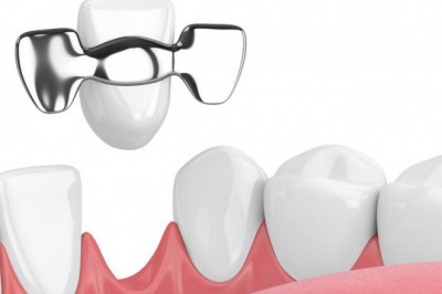 What Is the Most Used Type of Dental Implant?