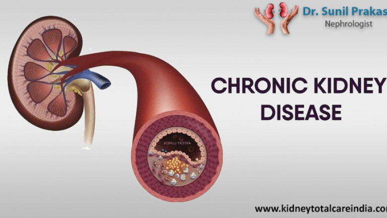 Chronic kidney disease: symptoms, prevention and treatment