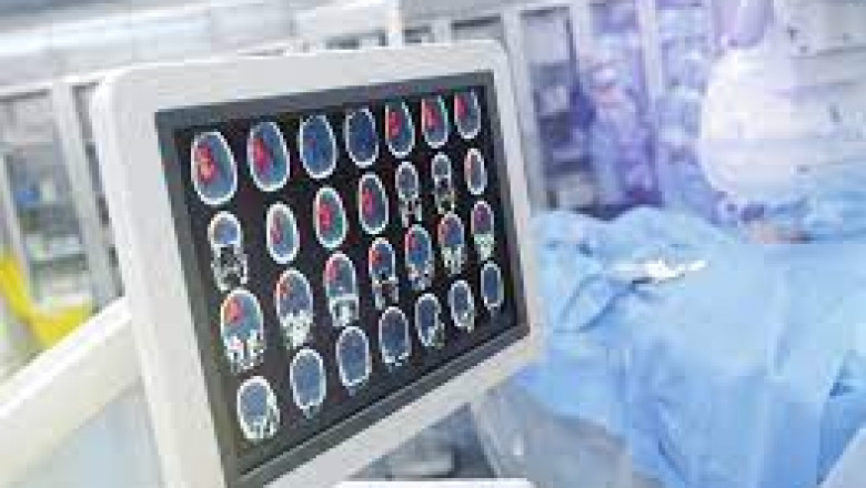 What Are The Most Common Neurosurgical Procedures?