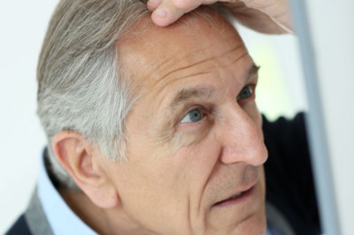 Haarausfall und Vitamine