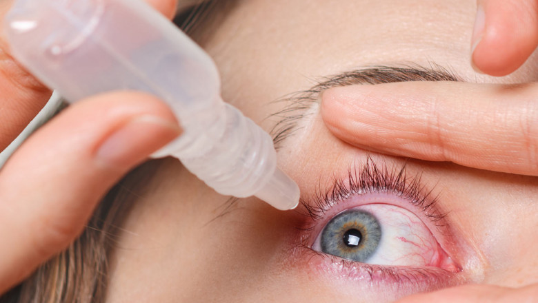 Vernal Keratoconjunctivitis Market Regional Analysis, 2021-2028