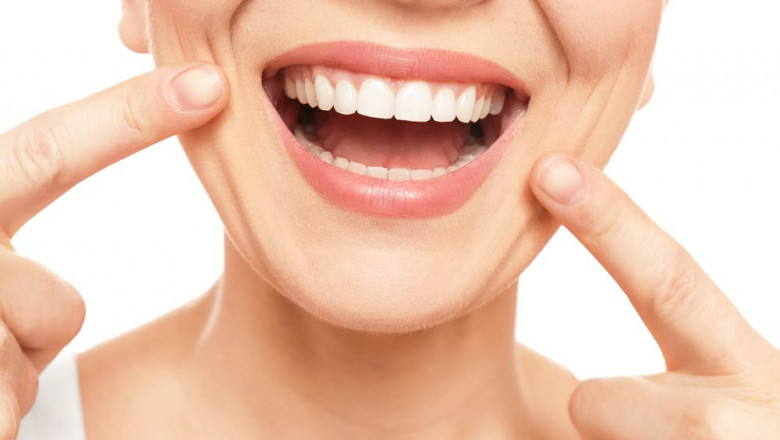 What Are The Benefits Of Braces?