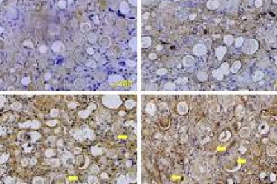 Poly (DL-lactic) Acid  Market 2022 - Latest Innovation, Sales Channels, Business Advancements, and Top-Vendor Landscape to 2031