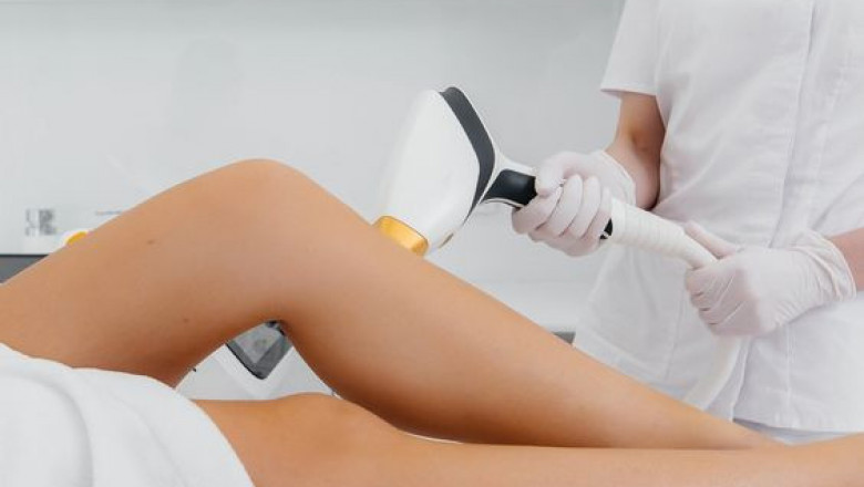 What kind of hair removal equipment is used for laser hair removal?