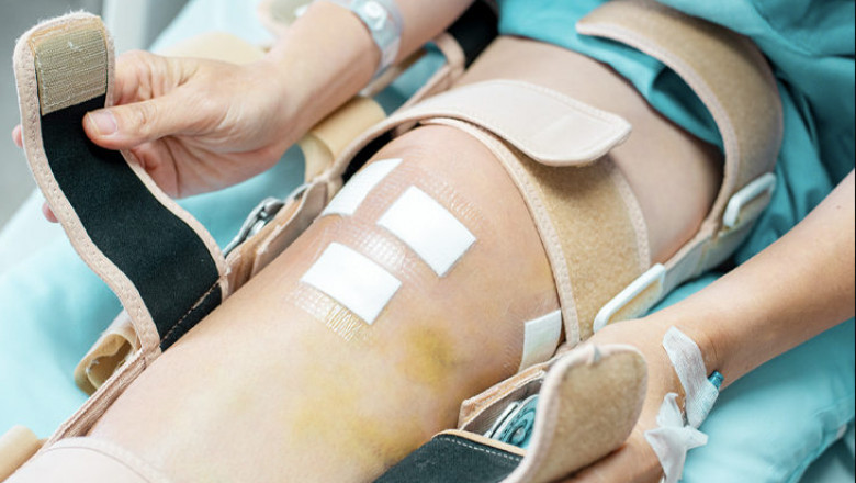 ACL Treatment in Chennai | Dr.Vivek AN Orthoclinics