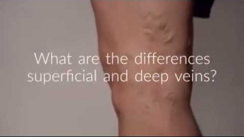The Difference Between Superficial and Deep Veins