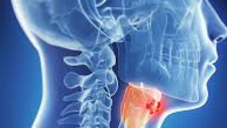 Cervical Cancer Treatment Market Research 2028 - Value Market Research