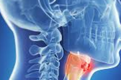 Cervical Cancer Treatment Market Research 2028 - Value Market Research