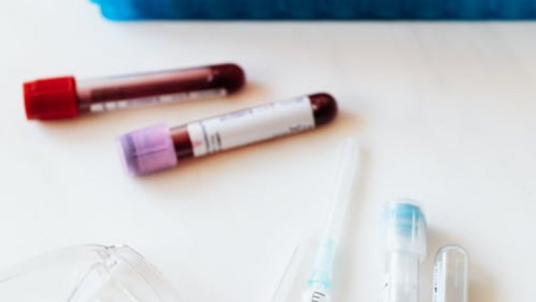 COVID-19 Saliva Screening Test Potential Market Size, Growth and Key Manufacturers