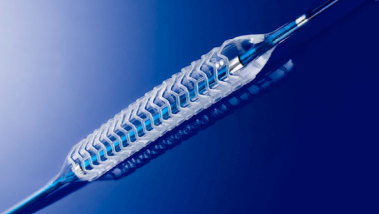 Bioabsorbable Stents Market Growth May Be Hindered By High Costs of These Stents