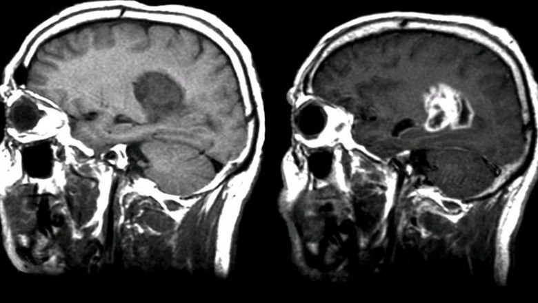 Contrast Media/Contrast Agent Market Regional Analysis