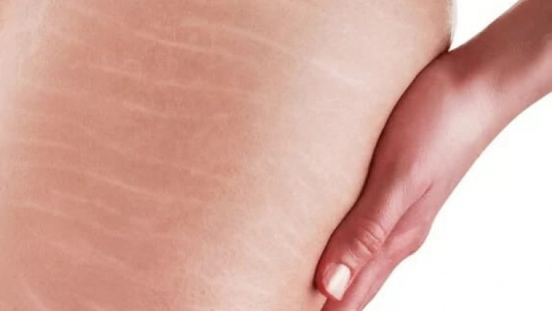 Worrying Meat Cracks? No Problem. Maruneko Nya Helps You to Totally Eliminate Them Forever