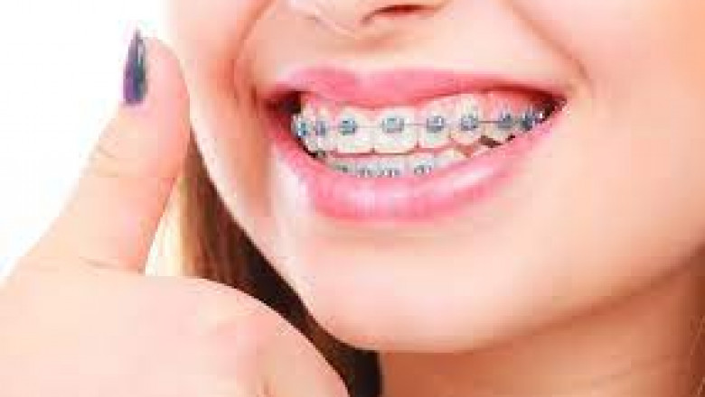 5 Trick Top Qualities to Look For in an Expert Orthodontist