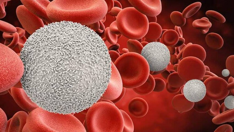 Blood Cancer – types, Diagnosis and Treatment
