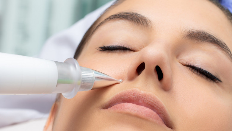 What Are The Beneficial Aspects Of Skinpen Treatment?