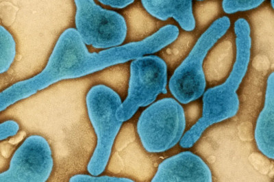 Marburg Virus Outbreak: Here is What You Need to Know