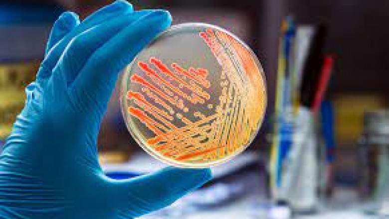 Report on Bioburden Testing Market Research 2028 - Value Market Research