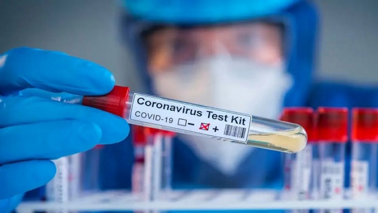 Tests' Performance For Coronavirus