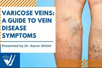 Varicose Veins: A Guide to Vein Disease Symptoms