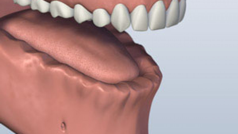 Full Mouth Changing to Adorn the Whole Mouth