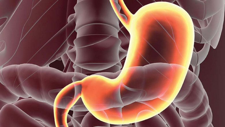 Brief about Peptic Ulcer Drugs